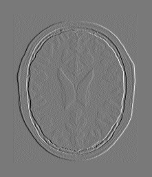 Image difference after registration.